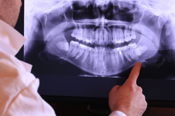 Best Dentist for Tooth Abscess  in Salem, IL