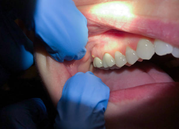 Best Emergency Tooth Extraction  in Salem, IL